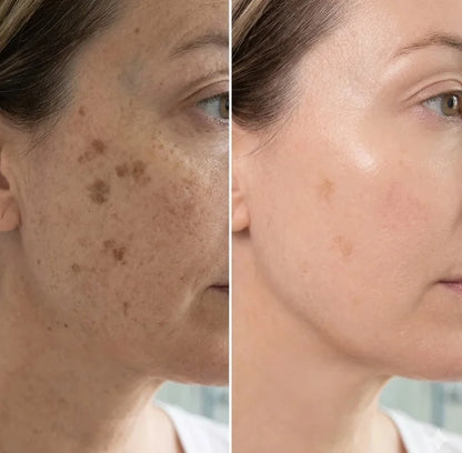 Serum z witaminą C C the Glow™ Dark Spot